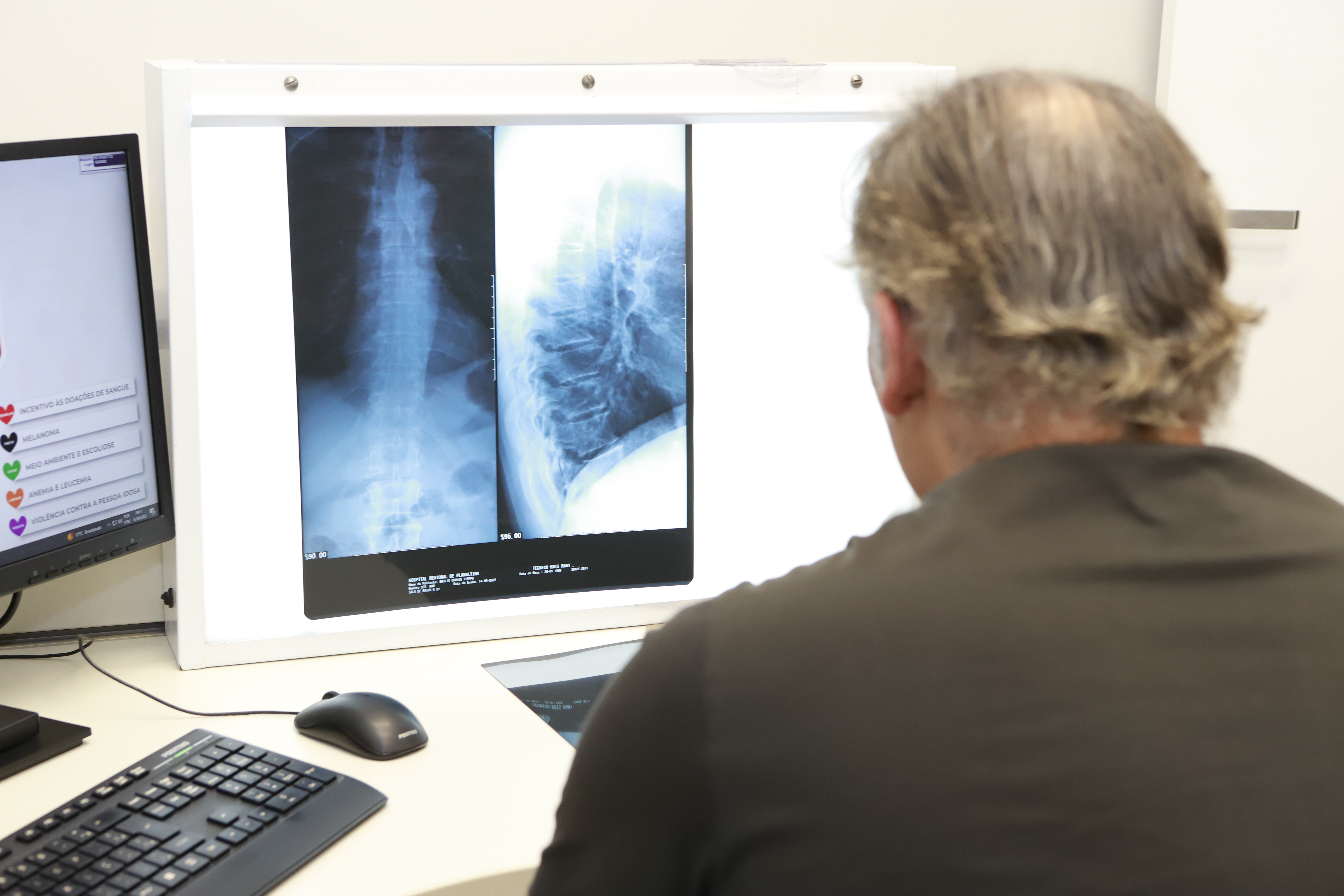 Capa da notícia: Audiência pública vai debater padronização de raio-X fixo digital nos hospitais do DF