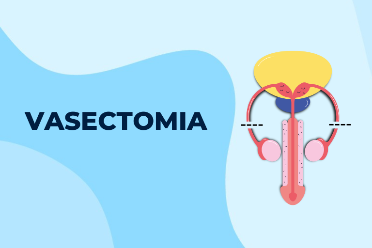 Capa da notícia: Vasectomia: opção segura e acessível de planejamento familiar