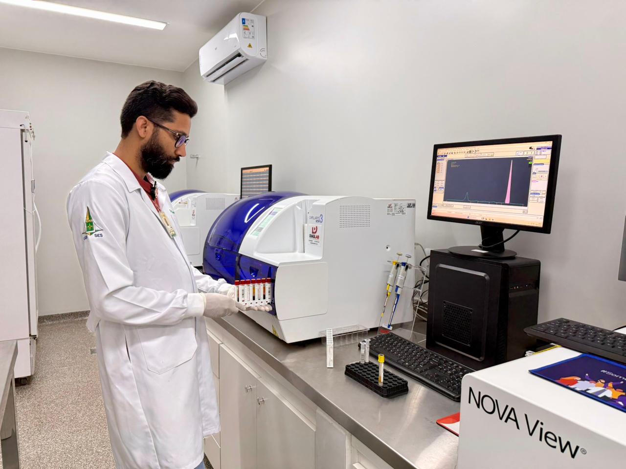 Capa da notícia: Saúde implanta novo exame de sangue na rede pública do DF